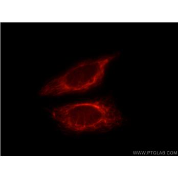 WSB2 Rabbit Polyclonal Antibody (12124-2-AP)