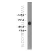 SAP130 Rabbit Polyclonal Antibody (12130-1-AP)