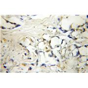 IP6K1 Rabbit Polyclonal Antibody (12057-2-AP)