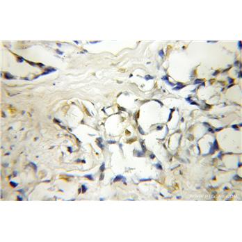 IP6K1 Rabbit Polyclonal Antibody (12057-2-AP)