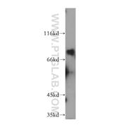 DYM Rabbit Polyclonal Antibody (12001-1-AP)