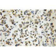 ARHGAP15 Rabbit Polyclonal Antibody (11940-1-AP)