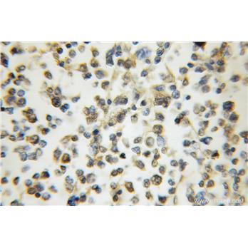 ARHGAP15 Rabbit Polyclonal Antibody (11940-1-AP)