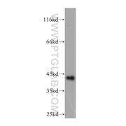 GDAP1L1 Rabbit Polyclonal Antibody (11977-1-AP)