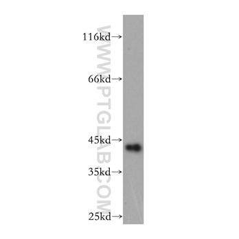 GDAP1L1 Rabbit Polyclonal Antibody (11977-1-AP)