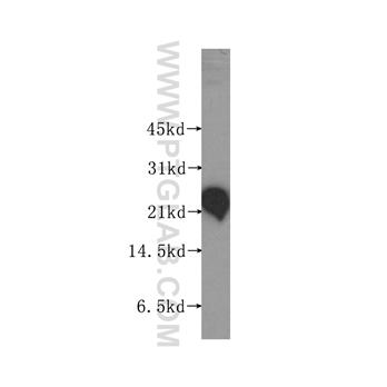 RTN3 Rabbit Polyclonal Antibody (12055-2-AP)