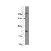 TRAPPC4 Rabbit Polyclonal Antibody (12074-1-AP)
