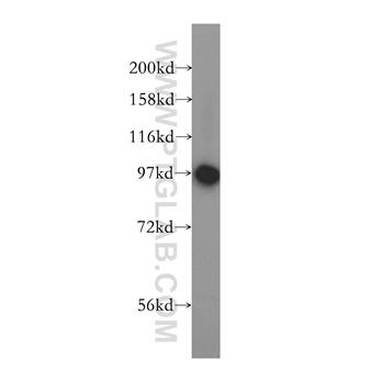 PYGB Rabbit Polyclonal Antibody (12075-1-AP)