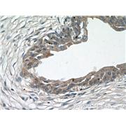 ZFP36 Rabbit Polyclonal Antibody (12737-1-AP)