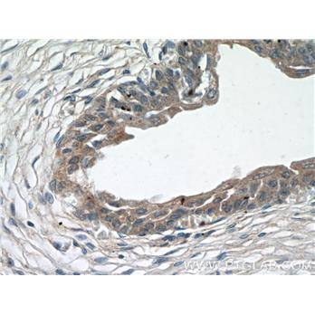 ZFP36 Rabbit Polyclonal Antibody (12737-1-AP)