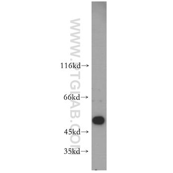 PIGB Rabbit Polyclonal Antibody (12612-1-AP)