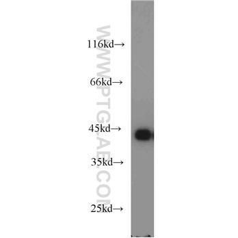 MAGEB1 Rabbit Polyclonal Antibody (12400-1-AP)