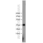 RPE Rabbit Polyclonal Antibody (12168-2-AP)