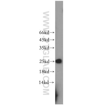 RPE Rabbit Polyclonal Antibody (12168-2-AP)