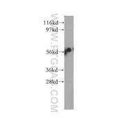 DAK Rabbit Polyclonal Antibody (12224-1-AP)