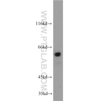 TRIP4 Rabbit Polyclonal Antibody (12324-1-AP)