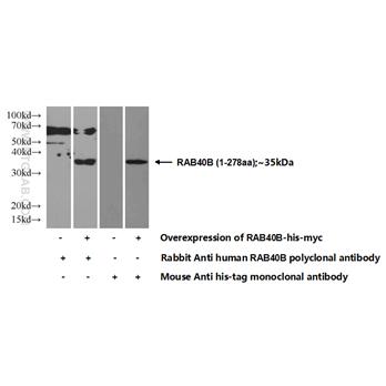 RAB40B Rabbit Polyclonal Antibody (12471-1-AP)