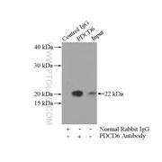 TBCA Rabbit Polyclonal Antibody (12304-1-AP)
