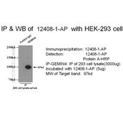 GEMIN4 Rabbit Polyclonal Antibody (12408-1-AP)
