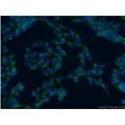 SNAP29 Rabbit Polyclonal Antibody (12704-1-AP)