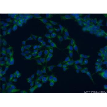 SNAP29 Rabbit Polyclonal Antibody (12704-1-AP)