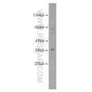 RHBDL2 Rabbit Polyclonal Antibody (12467-1-AP)