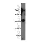 ZWINT Rabbit Polyclonal Antibody (12282-2-AP)