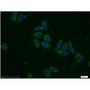 DPP8 Rabbit Polyclonal Antibody (12752-1-AP)