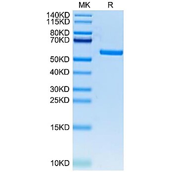 FITC-Labeled Human HLA-A*11:01&B2M&KRAS WT (VVVGAGGVGK) Monomer Protein (MHC-HM429F)