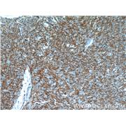ANO1 Rabbit Polyclonal Antibody (12652-1-AP)