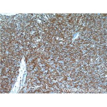 ANO1 Rabbit Polyclonal Antibody (12652-1-AP)