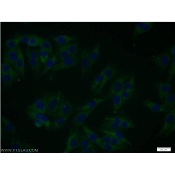 SGK3 Rabbit Polyclonal Antibody (12699-1-AP)