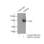 FKBP10 Rabbit Polyclonal Antibody (12172-1-AP)