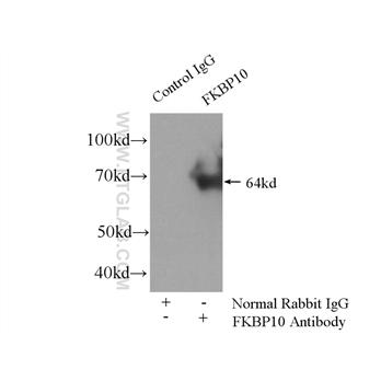FKBP10 Rabbit Polyclonal Antibody (12172-1-AP)