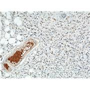 SULF2 Rabbit Polyclonal Antibody (12260-1-AP)