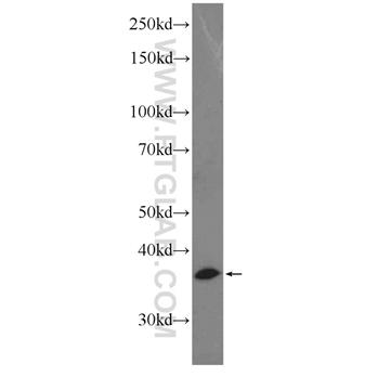 SIAH2 Rabbit Polyclonal Antibody (12651-1-AP)