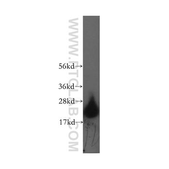 HPCAL4 Rabbit Polyclonal Antibody (12470-1-AP)