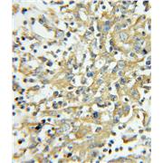 PRKCSH Rabbit Polyclonal Antibody (12148-1-AP)