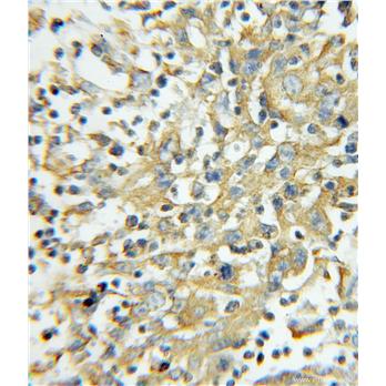 PRKCSH Rabbit Polyclonal Antibody (12148-1-AP)