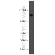 DNAI1 Rabbit Polyclonal Antibody (12756-1-AP)