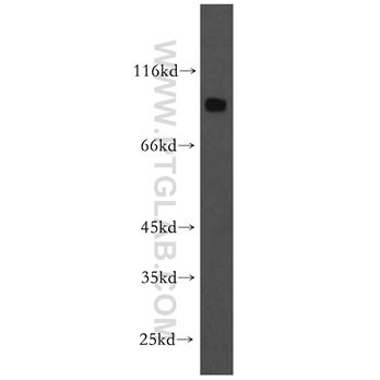 DNAI1 Rabbit Polyclonal Antibody (12756-1-AP)