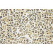 HS2ST1 Rabbit Polyclonal Antibody (12453-1-AP)
