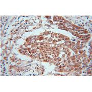 CALCOCO2 Rabbit Polyclonal Antibody (12229-1-AP)
