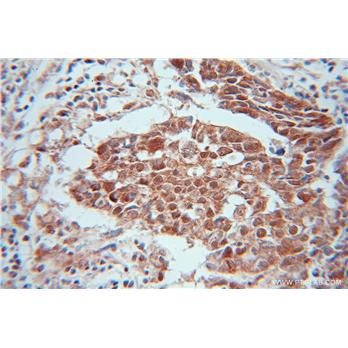 CALCOCO2 Rabbit Polyclonal Antibody (12229-1-AP)