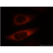 NDRG4 Rabbit Polyclonal Antibody (12184-1-AP)