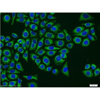 NTF4 Rabbit Polyclonal Antibody (12297-1-AP)