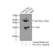 SULT1E1 Rabbit Polyclonal Antibody (12522-1-AP)