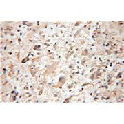 PTS Rabbit Polyclonal Antibody (12150-1-AP)