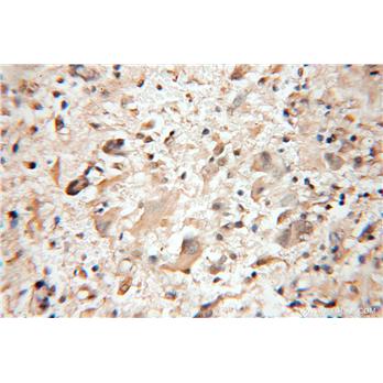 PTS Rabbit Polyclonal Antibody (12150-1-AP)