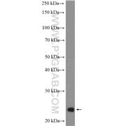 RALB Rabbit Polyclonal Antibody (12340-1-AP)
